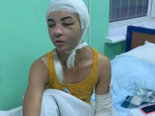 «Навіть перебуваючи в СІЗО, погрожував своїм жертвам»: у Києві вийшов на волю садист, якого звинувачують у вбивстві та звірячому побитті жінок