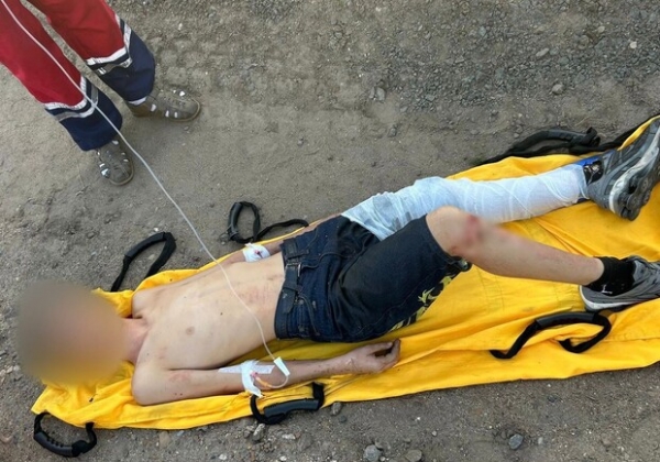 Под Одессой двое подростков забрались на крышу вагона ради фото и получили серьезные ожоги